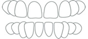 Lücken zwischen den Zähnen · Fachzahnarzt für Kieferorthopädie Witten Peter Brünger